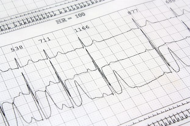 Heart EKG