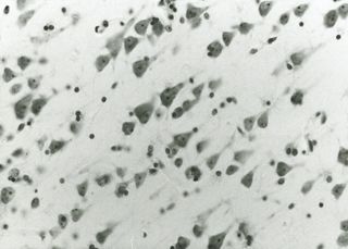 A close-up scan of one of a slide of Albert Einstein's brain.