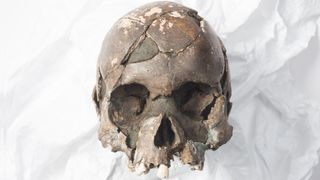The preserved skull of Vistegutten, Norwegian for "the boy from Viste."