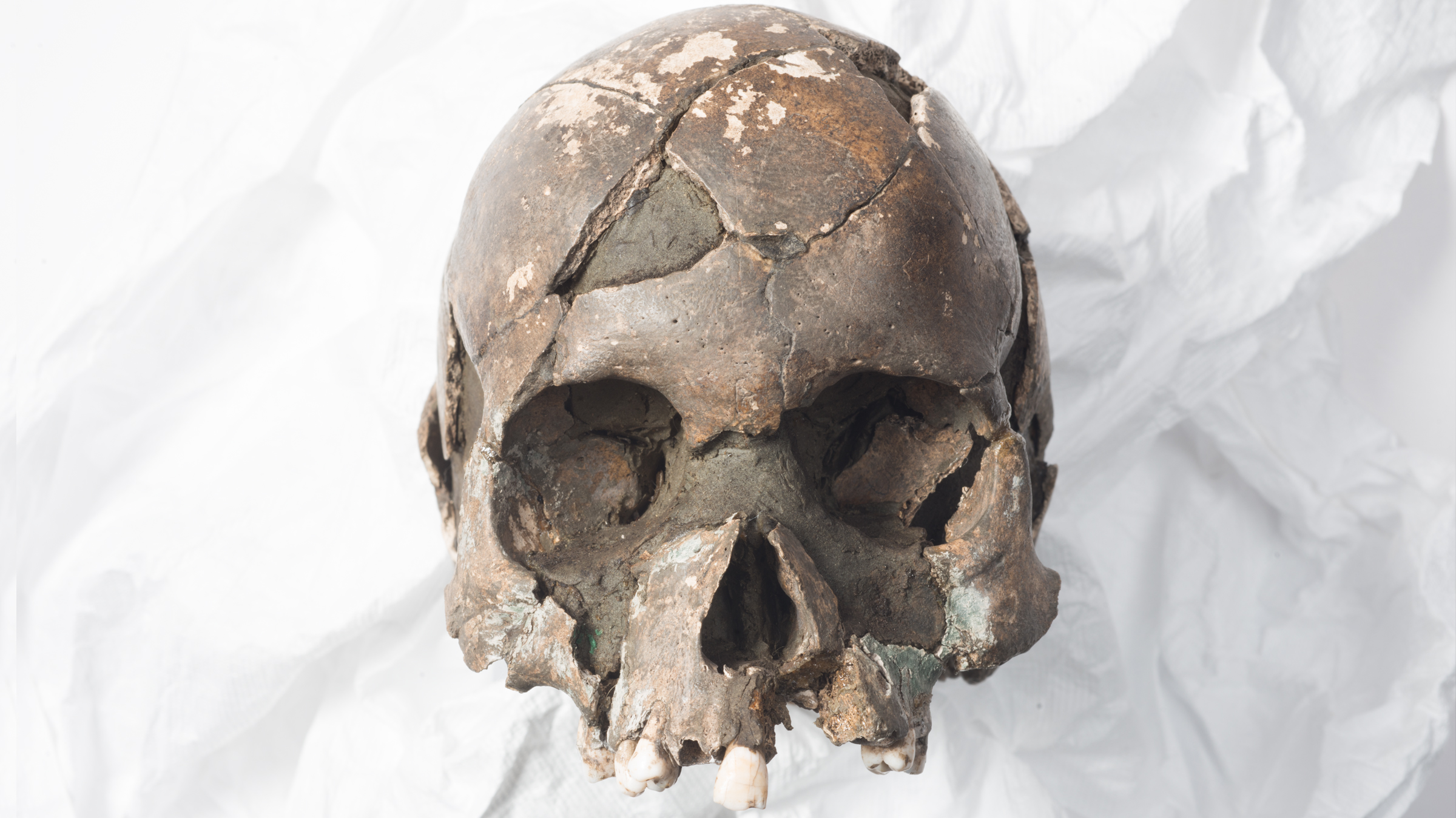 Le crâne conservé de Vistegutten, norvégien pour 