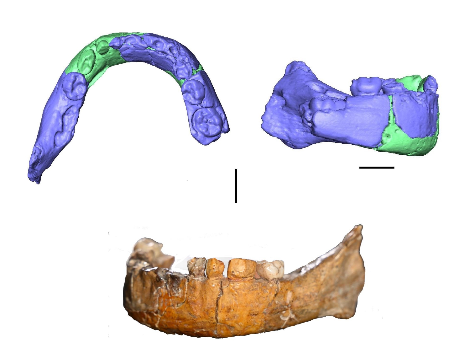 CT scans and a photograph of the Skhul I jaw.