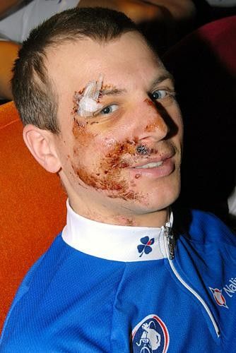 Francis Mourey (French 'cross champ) just back from the Worlds where he didn't start because of a big crash during training on last Friday.