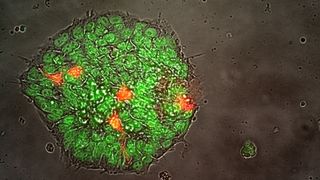 a cell glows green under a microscope