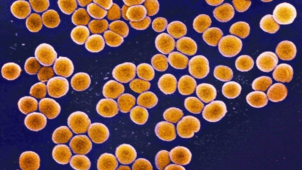 Superbugs evolve inside the human body — tracking them in real time could help save patients, scientists say