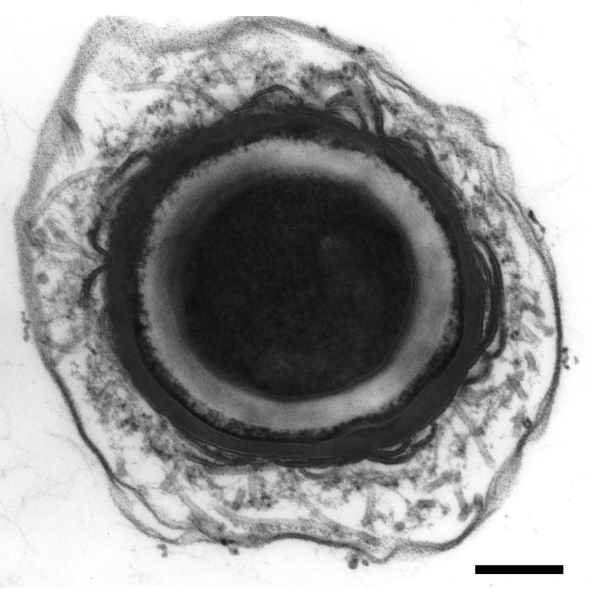 A spore of Clostridium botulinum, the bacterium ultimately responsible for causing botulism.