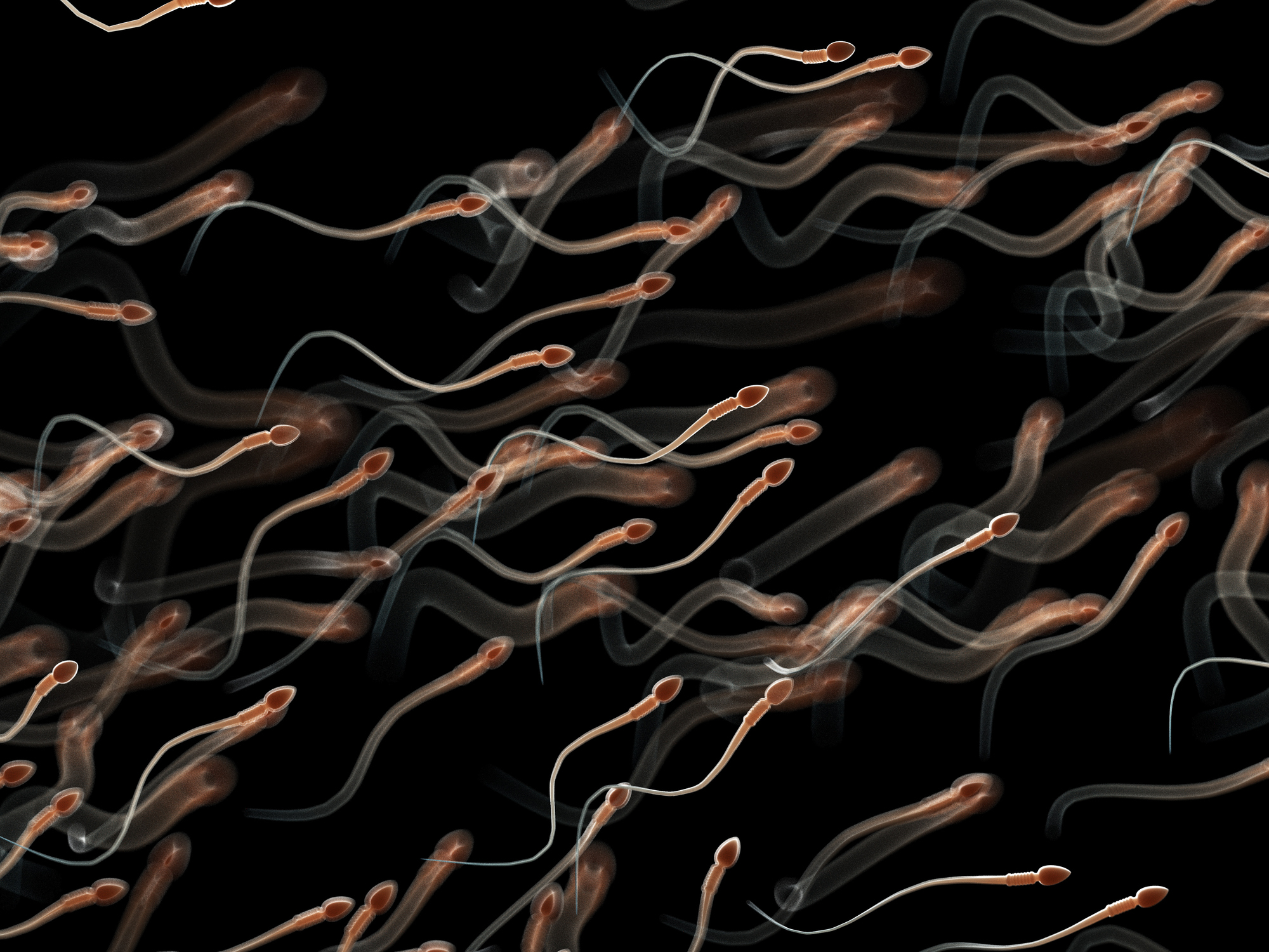 Illustration of dozens of human sperm.