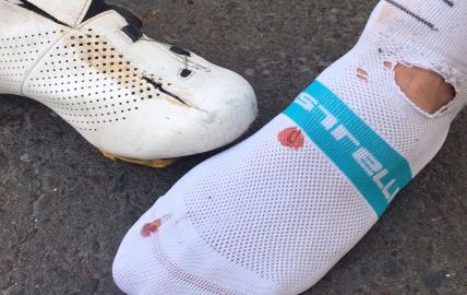 Owain Doull's foot and shoe after the crash