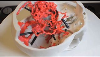 3D printed models, like the one of brain tissue above, can aid surgeons in medical procedures.