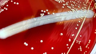 photo shows a close up of Nocardia bacterial colonies grown on a red petri dish.