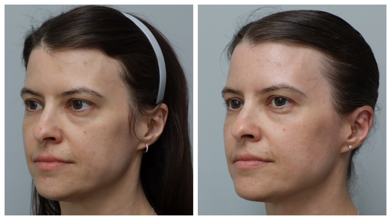 two images side by side of a white woman with bare skin, brown hair, and brown eyes