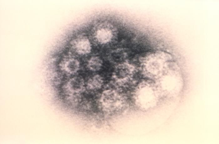 Enteroviruses