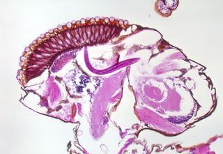 The pink, wormy swoosh visible in the center of this image is <em>Onchocerca volvulus</em>, a nematode seen developing in a black fly.