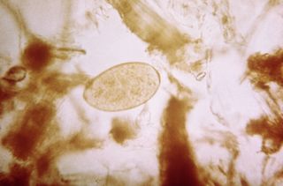 This unassuming oval is the egg of <em>Fasciola hepatica</em>, the sheep liver fluke.