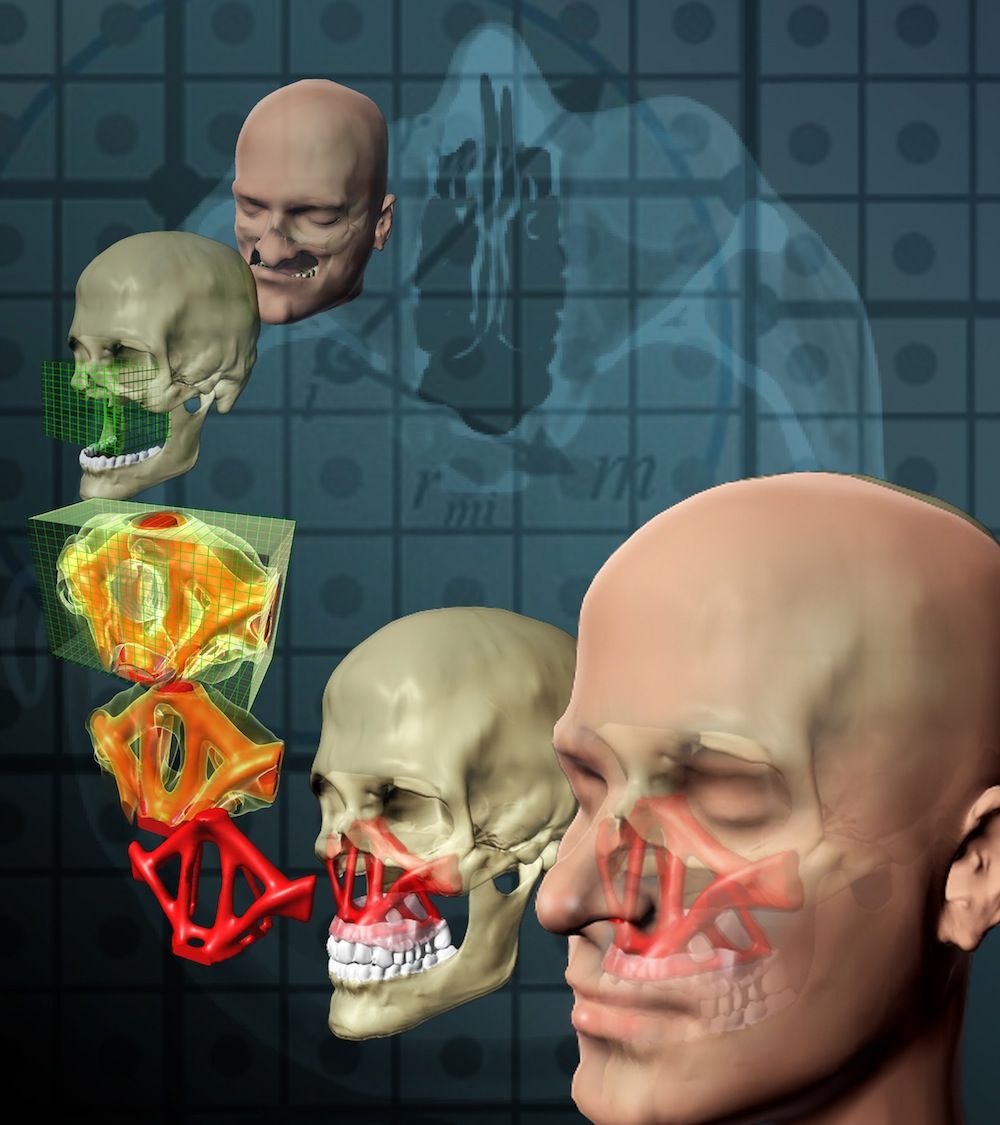 national science foundation, nsf, behind the scenes, bts, topological optimization, craniofacial injury, tissue engineering, surgery, reconstructive surgery