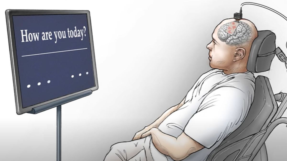 illustration shows a man with a brain implant sitting in a chair; a cross section of the man&#039;s head shows that the implant lays on top of his brain and has a plug sticking out of the top of his head. The plug is attached to a wire that leads to a device behind the main and plugs into a monitor, on which are the words &quot;How are you today?&quot;