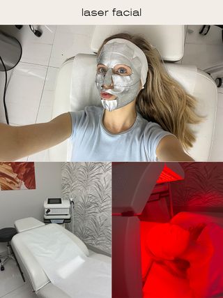 Emma Walsh laser facial