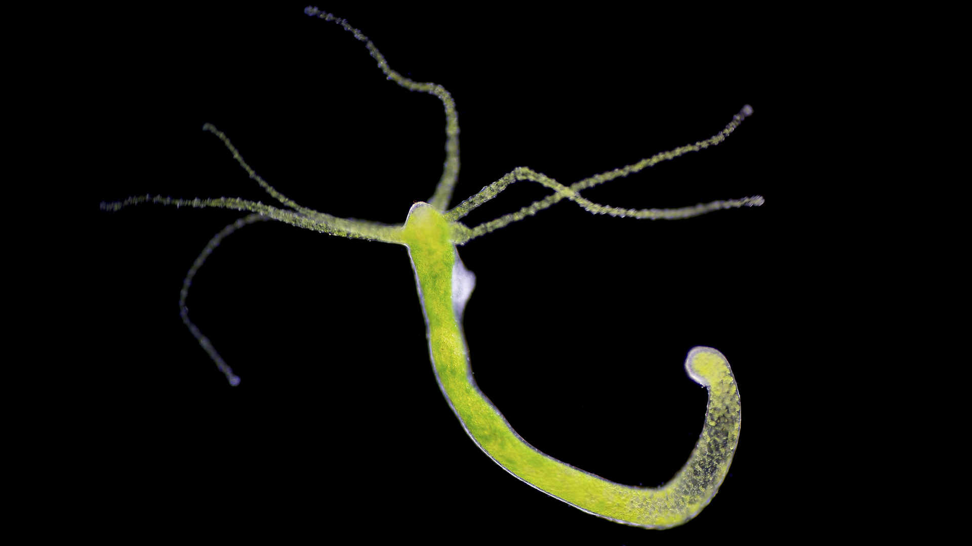Hydras can regenerate lost body parts — even their heads.