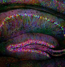 brain&rsquo;s hippocampus with fluorescent lighting agent
