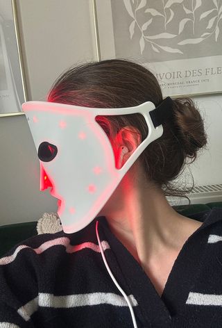 The fit of the Beauty Pe LED mask from the side