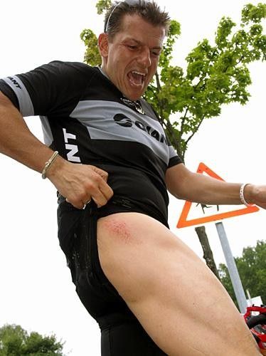 Deja vu. As was the case last year, Taufig shows off his crash damaged hip.