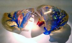 liver printed