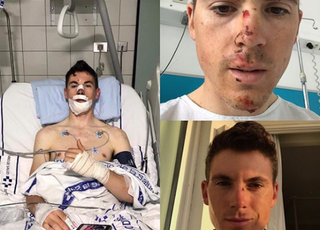 Ben Swift posted photographs of his injuries on social media