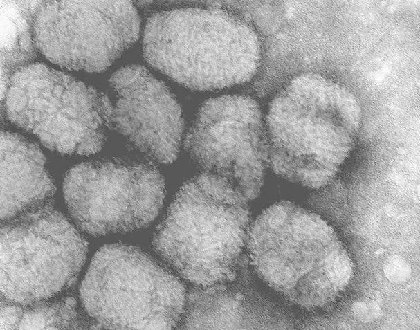 smallpox virus