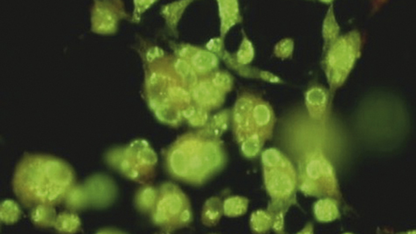 Equine herpes virus