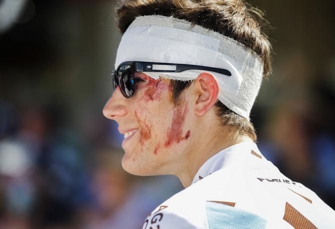 Julian Kern the day after a nasty crash in 2013