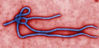 A microscopic view of the Ebola virus.