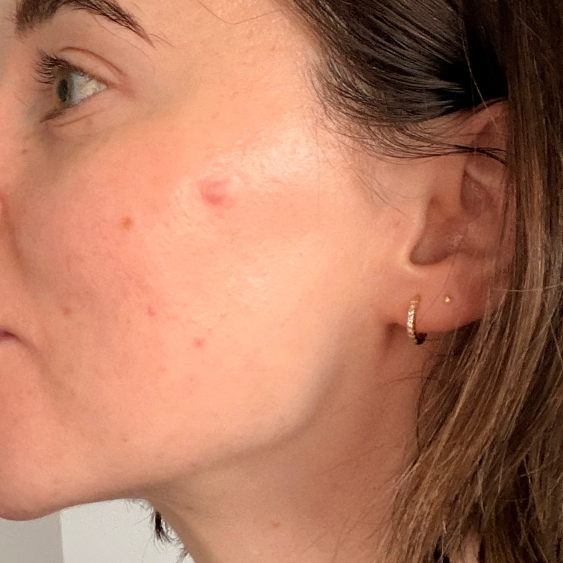 Grace while wearing the hero mighty patch on her skin