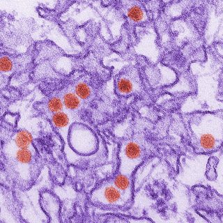 A transmission electron micrograph (TEM) of Zika virus.