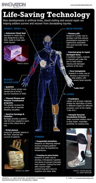 Infographic: How new prosthetics and medical techniques are saving soldiers' lives after the battlefield