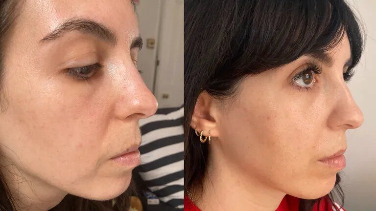Beauty editor Stephanie before (l) and after (r) using the Solawave Skincare Wand