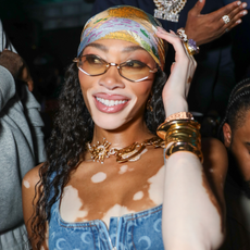 Winnie Harlow poses for a picture at The Urban at Teyana Taylor's birthday celebration on December 7, 2024 in Miami, Florida