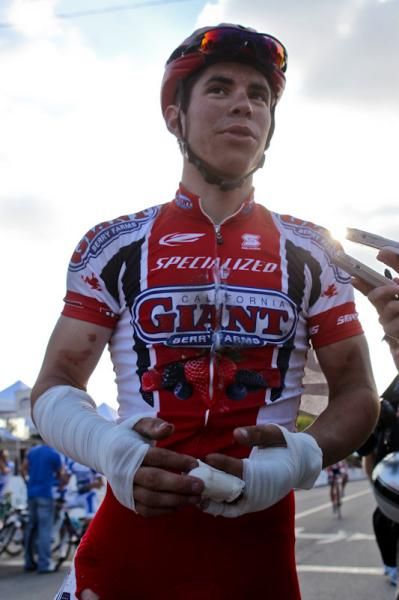 John Bennett (California Giant-Specialized) was just a little banged up after crashing out of the break.