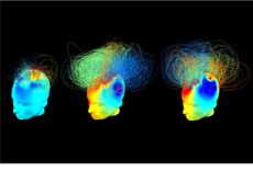 These are brain networks in two vegetative patients (left and middle), alongside a healthy adult (right). The vegetative patients appeared behaviorally similar but one of them (middle) showed signs of hidden awareness during a previous fMRI study.