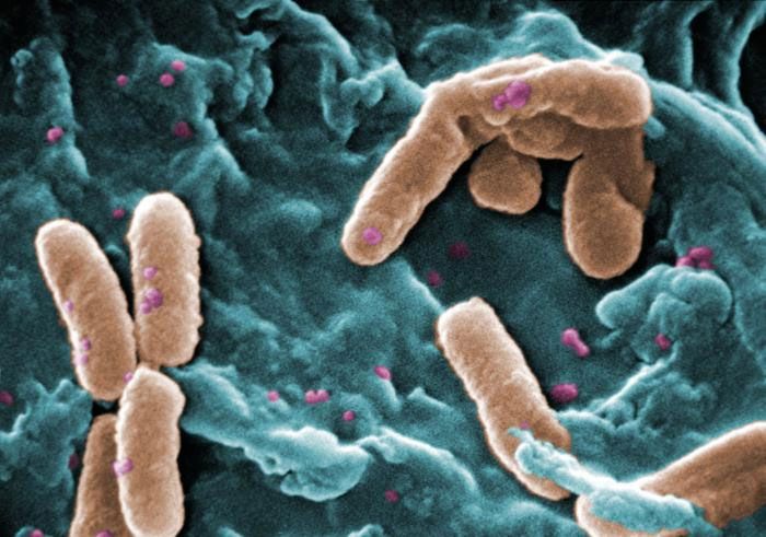 Super-Superbugs: Antibiotic-Resistant Bacteria May Be Deadlier | Live ...