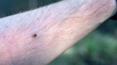Lone star tick on human arm