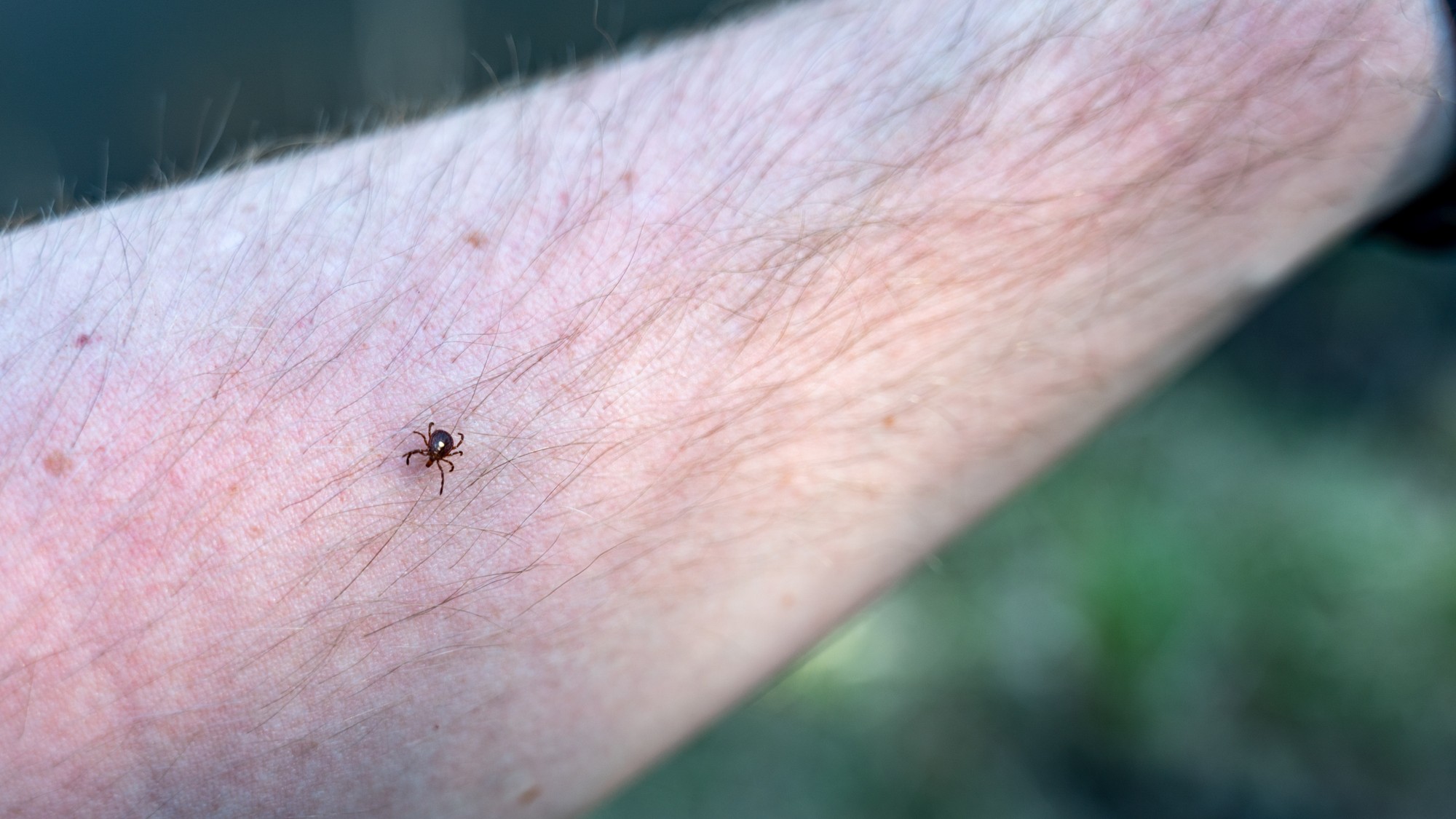 Lone star tick on human arm