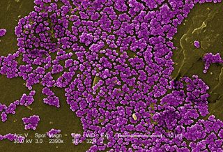 mrsa bacteria under a microscope