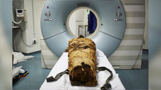 The mummified body of the ancient Egyptian priest Nesyamun underwent medical scans in 2018 so that a copy of its vocal tract could be made.