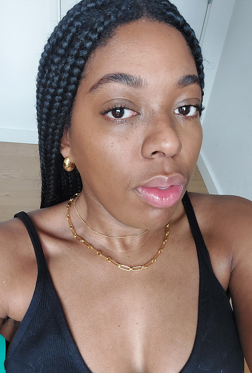 Remy before using omnilux LED mask