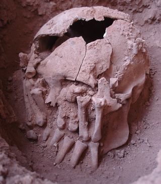 Amputated hands had been laid over the face of the decapitated skull and arranged opposite each other.