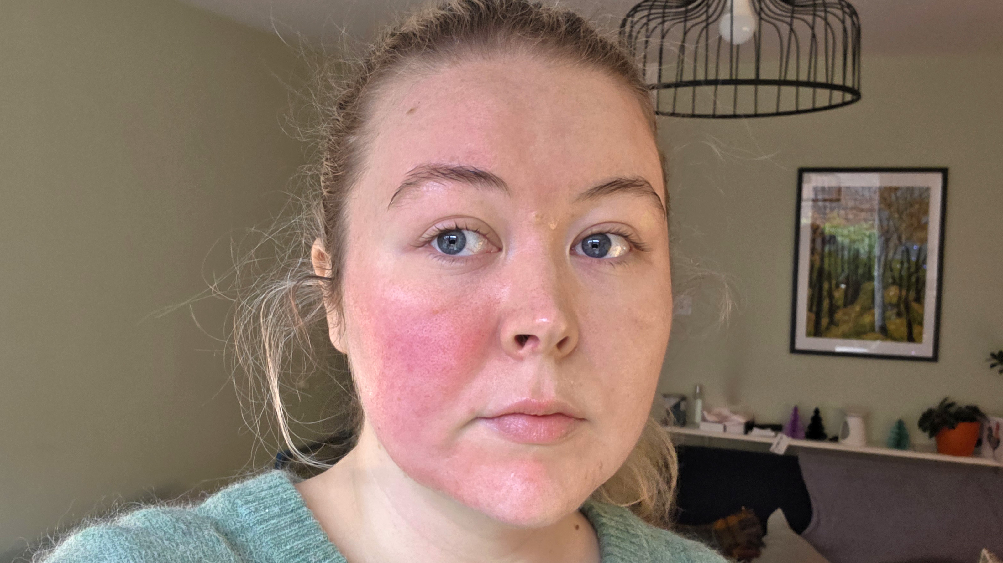 Shark FacialPro Glow