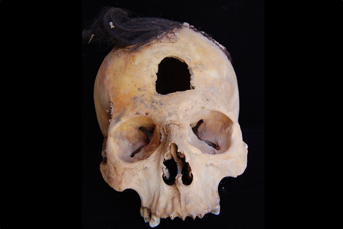 One of six trophy heads found in the 27 funerary pits. The dry climate in southern Peru allowed for the hair of the person to be preserved despite the passage of about 1,500 years. 