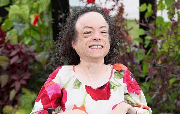 liz carr