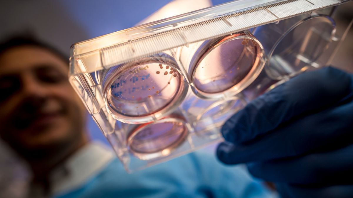 Close-up image of a petri dish containing lab-grown mini brains being held by a scientist wearing blue gloves. The scientist&#039;s face can be seen blurred in the background