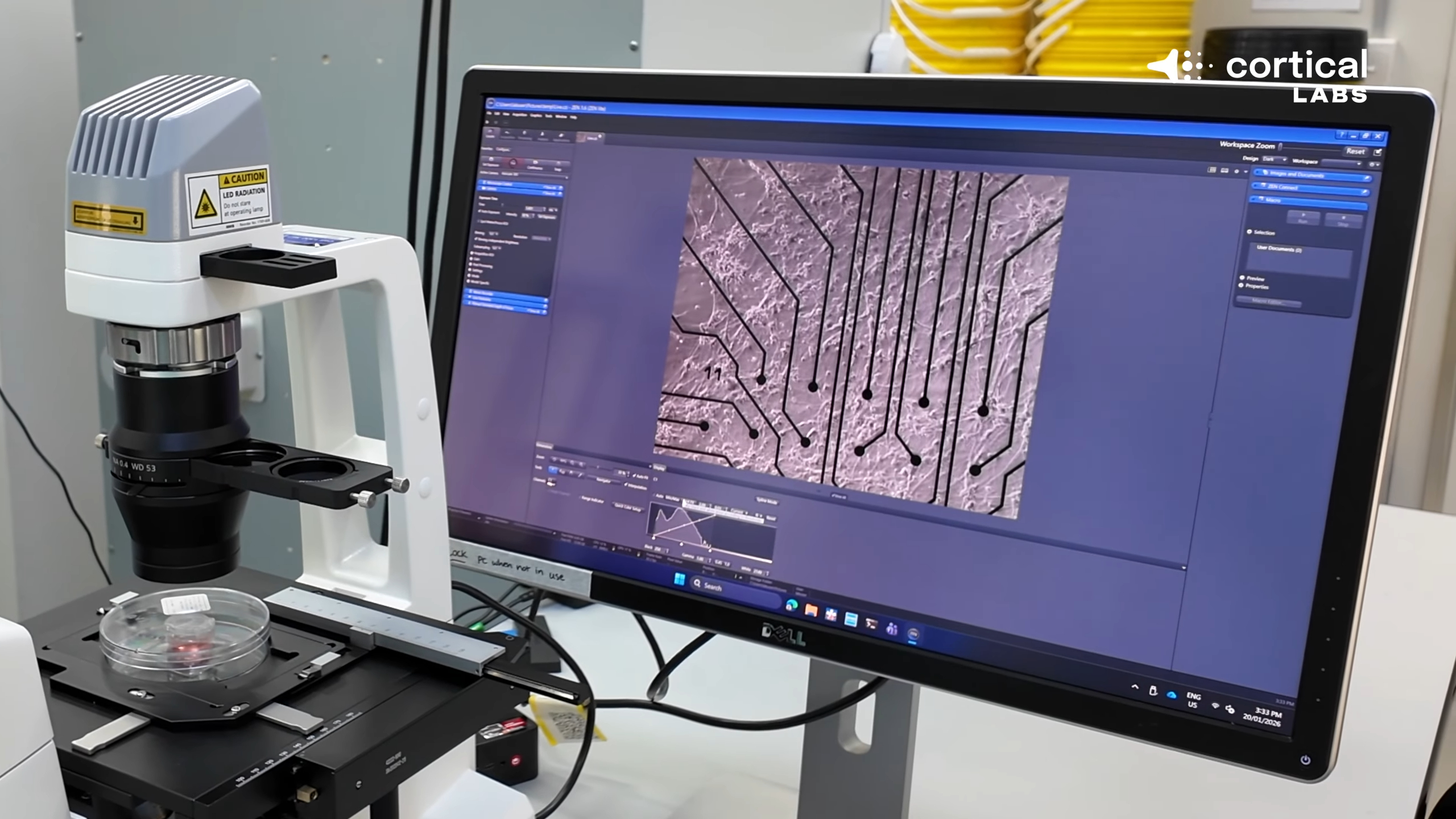 Cortical Lab's slide of human neurons viewed under a microscope, displayed on a monitor.