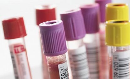 Doctors will reportedly use the new blood test initially to predict which treatments would work best for each patient's specific tumor.